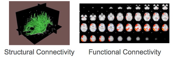 structural and functional connectivity